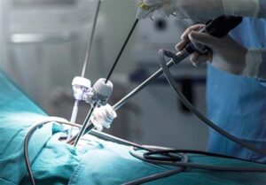 عمل جراحی لاپاراسکوپی موفق در کرج/ خروج کیست مویی 10 سانتی