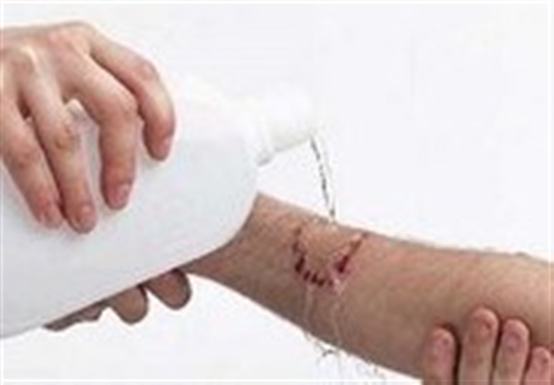 افزایش 16 درصدی موارد حیوان‌گزیدگی در مرکز و غرب استان سمنان