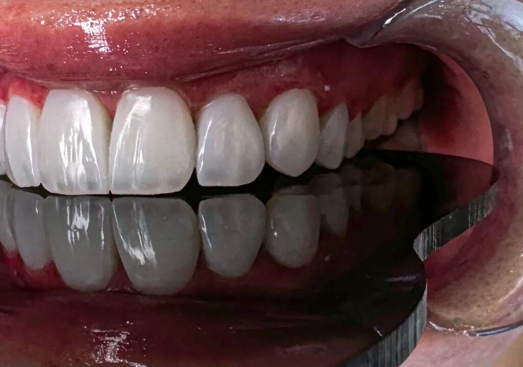افزایش تقاضا برای خدمات زیبایی دندان در تهران؛ فرصت یا تهدید؟