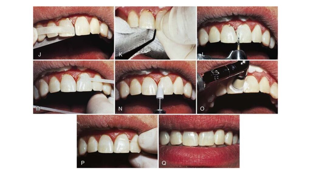 ارتودنسی ارزان در کرج
