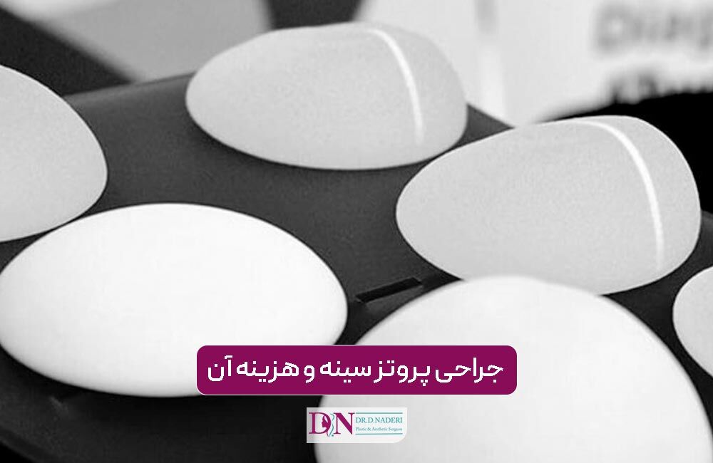 جراحی پروتز سینه و هزینه آن در سال 1405