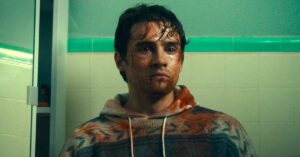 Young Man with Blood on His Face Stands in a Tiled Bathroom Wearing a Patterned Hoodie