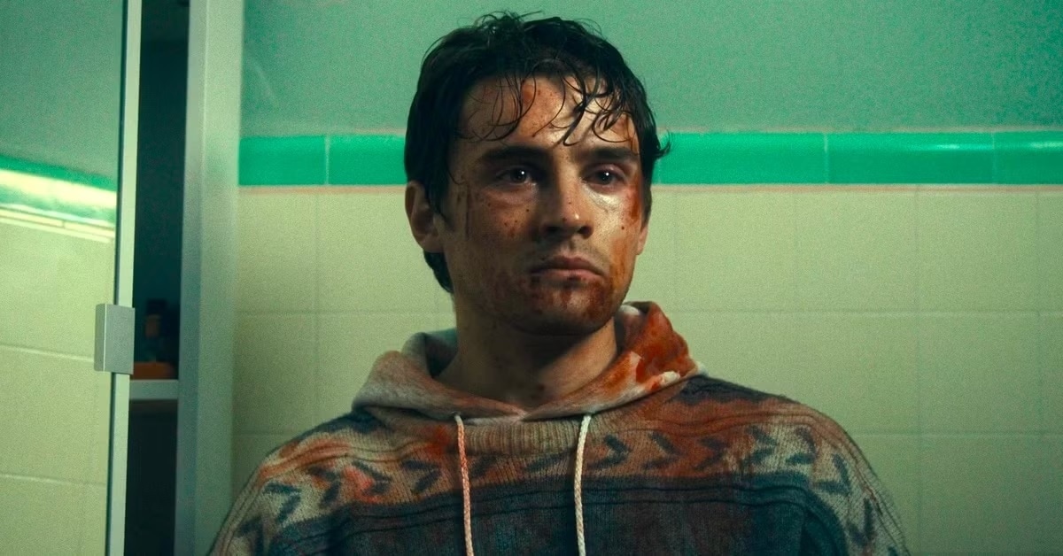 Young Man with Blood on His Face Stands in a Tiled Bathroom Wearing a Patterned Hoodie